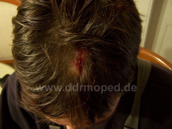 Angefgtes Bild